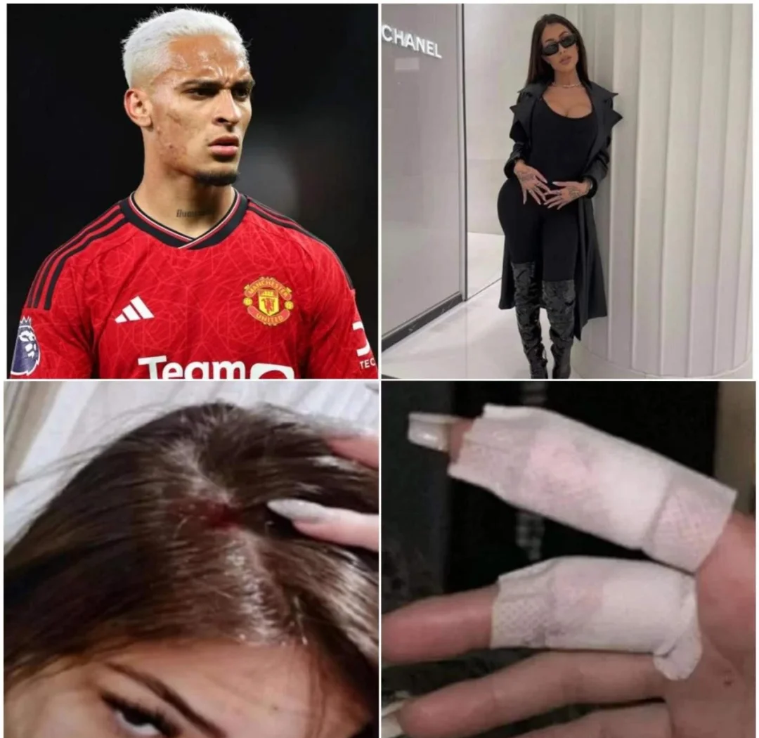  科维托娃赛事官方发布关键助攻新规，曼联争议不断！